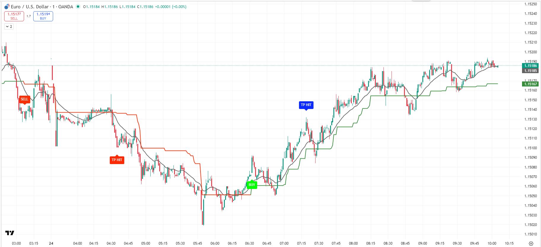 EURUSD CHART GFVGHFGYDC